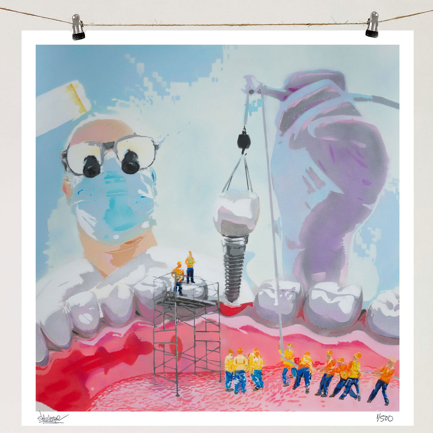 Dental Implant - Giclée Print - Spencer Couture