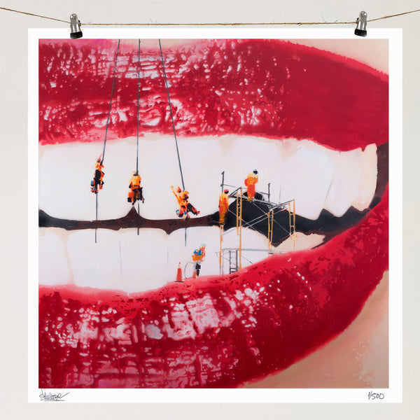 Dental Work - Limited Edition Street Art Print by Spencer Couture