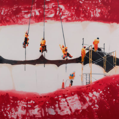Dental Work - Limited Edition Street Art Print by Spencer Couture